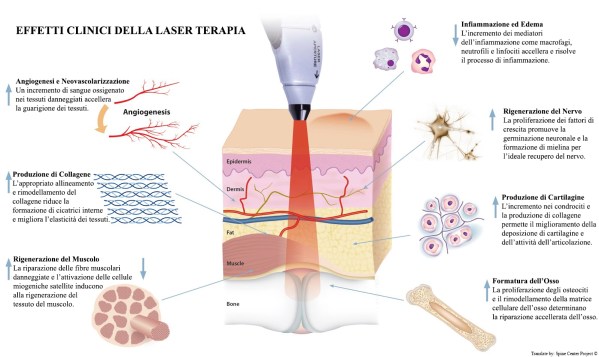 effects-laser-therapy